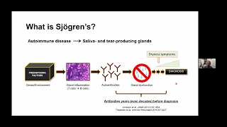 Sjögren’s and Lupus