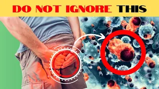 10 Critical Colon Cancer Symptoms You Should Never Ignore