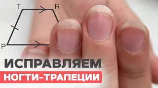 How to fix trapezoidal nails? | Nails for a drummer