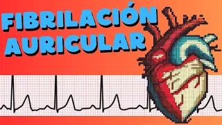 ¿Qué es la fibrilación auricular?