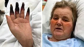 2 Tage nach der Reinigung bemerkte die Frau, dass ihre Finger schwarz wurden