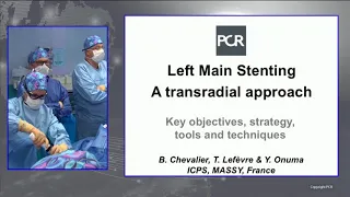 Left main and complex bifurcation stenting - A transradial approach