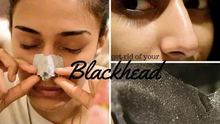 How to get rid of blackheads | skin care | innisfree | ERICA FERNANDES
