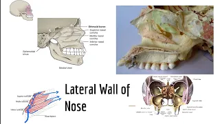 Lateral wall of nasal cavity