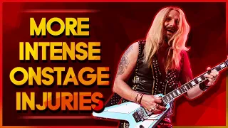 10 MORE Intense Live Concert Injuries