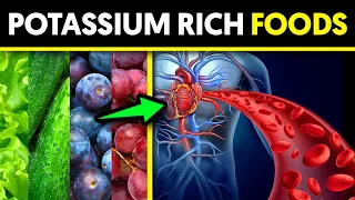8 Potassium Rich Foods That Reduce Blood Pressure
