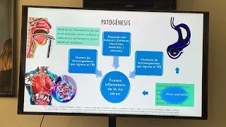 Neumonía asociada a la ventilación mecánica