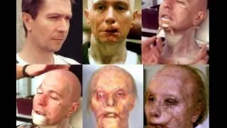 Gary Oldman's makeup for Hannibal 2001