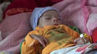 Yemen's starving children, a tragic legacy of war | AFP