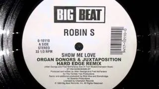 Organ Donors & Juxtaposition - Show Me Love (FREE DOWNLOAD)