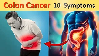 10 Critical Colon Cancer Symptoms Never Ignore It