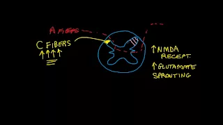 Central Sensitization and C Fibers