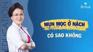 Mọc mụn ở nách có sao không: Nguyên nhân cách trị