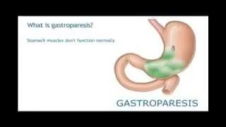 Gastroparesis