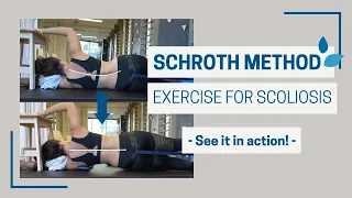 SCHROTH METHOD demo - Side-Lying Scoliosis Treatment Exercise