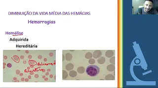 Interpretação do Hemograma - Fisiopatologia das Anemias