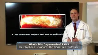 What is Disc Degeneration? Part 1
