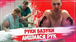 Руки базуки удалили / Кирилл Терешин лишился рук в больнице