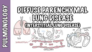 Interstitial Lung Disease (ILD) - Classification, pathophysiology, signs and symptoms