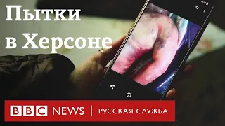 «Я весь день слышал, как пытают других». Рассказы о пытках в Херсоне во время оккупации