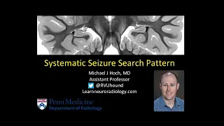 Brain MRI - Seizure search pattern