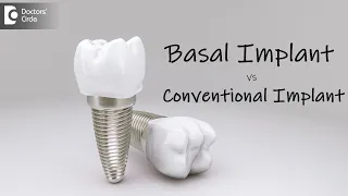 Comparison between basal and Conventional Implants - Dr. Shahul Hameed|Doctors' Circle
