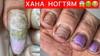 УБИТЫЕ НОГТИ ПРИШЛИ НА МАНИКЮР 😱