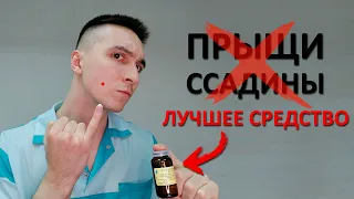 Лучшее средство от прыщей, царапин и синяков. Цинковая паста. Эффективный и безопасный метод