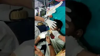 Removing Stuck Coin from throat with smart technique by Doctor #medicine #surgery #medicalstudent