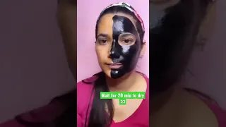 Charcoal Peel of Mask🌘Vs Everyuth orange peel of mask|black & whiteheads removal😱|#short#ytbshorts