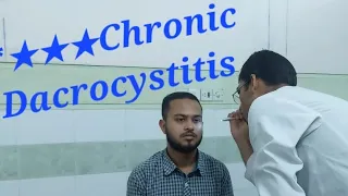 Chronic Dacrocystitis | Eye Short Case