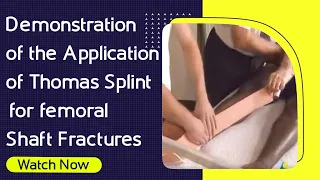 Demonstration of the Application of Thomas Splint for femoral Shaft Fractures