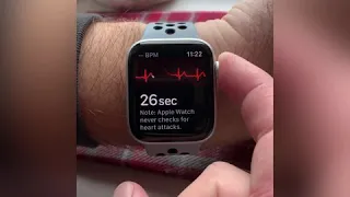 Как проверить работу сердца ❤️ с помощью Apple Watch 6