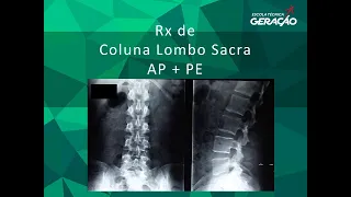 Radiografia da Coluna Lombo Sacra AP + Perfil - Ortostática