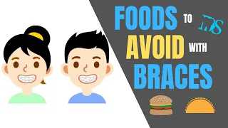Foods To Avoid With Braces