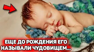 Врачи говорили беременной, что у нее родится чудовище! Вот как выглядит..