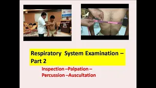 Examination of Respiratory System  Part 2 l Clinical Examination l @ Ayurveda Academy l