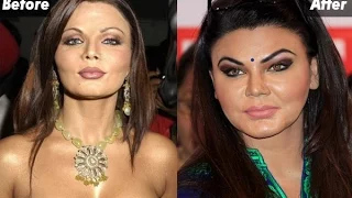 BEFORE & AFTER  Plastic Surgery Of Popular TV Actresses by 'Celebrities