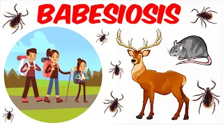 Babesiosis - A Babesia microti Infection