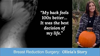 Breast Reduction Surgery | Olivia's Story