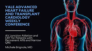 AV Junction Ablation and CRT for Patients with Permanent Afib and Narrow QRS