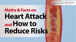 Myths & Facts on Heart Attack and How to Reduce Risks