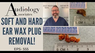 SOFT & HARD EAR WAX REMOVAL - EP555