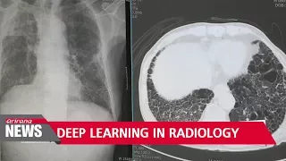 Deep learning applied in radiology to accurately diagnose patients