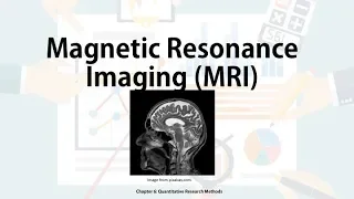 Techniques to study the brain - MRI (Biological Approach in IB Psych)