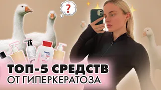 ТОП-5 СРЕДСТВ ОТ ГИПЕРКЕРАТОЗА | ГЛАДКАЯ КОЖА | УБИРАЕМ ПРЫЩИ НА ТЕЛЕ