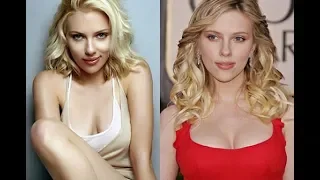 Celebrities Plastic Surgery Transformations -  40 Stars Before After Plastic Surgery