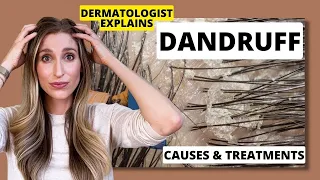 Dermatologist Explains Dandruff: What Causes it & Best Dandruff Treatments! | Dr. Sam Ellis