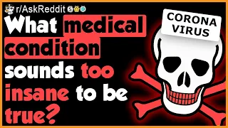 Medical conditions too insane to be true - (r/AskReddit)