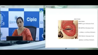 #Live-Webinar Basic Principles of Oculoplastic Procedures - Dr. Apjit Kaur